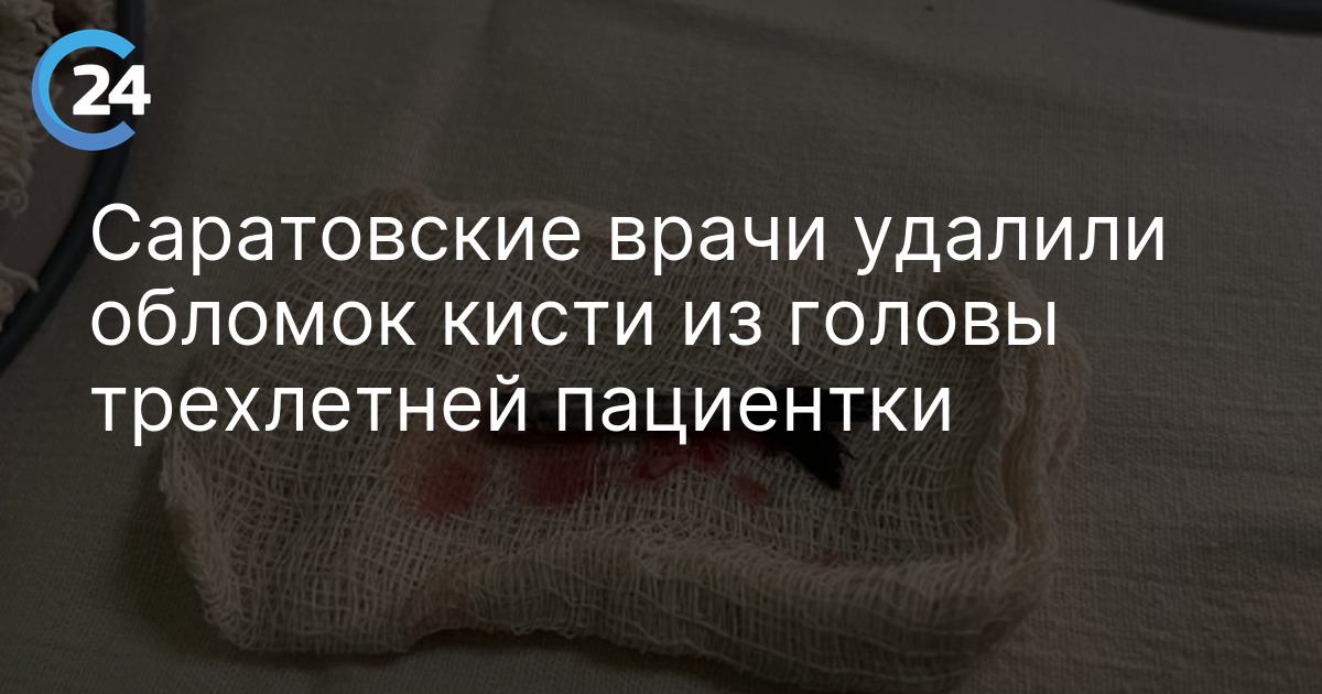 Саратовские врачи удалили обломок кисти из головы трехлетней пациентки