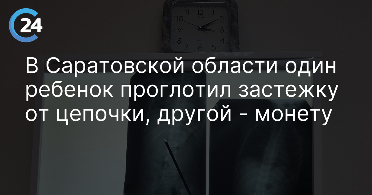 В Саратовской области один ребенок проглотил застежку от цепочки, другой - монету